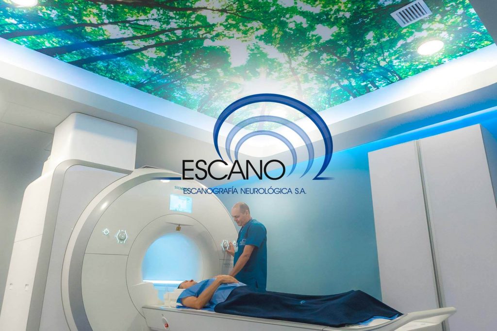 Beneficio Club Intelecto Escano